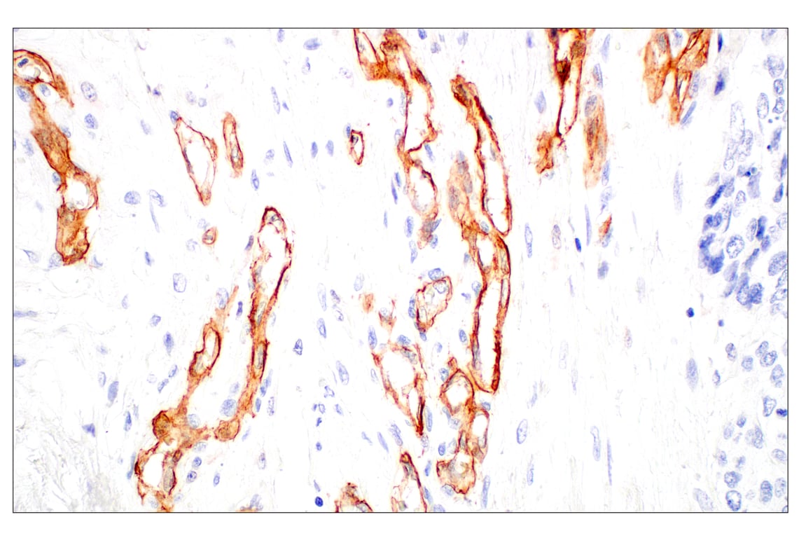 Immunohistochemistry Image 2: CD93/C1qR (E5H9B) Rabbit Monoclonal Antibody