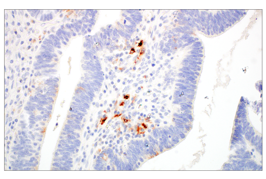 Immunohistochemistry Image 2: LAMP3/CD208 (E6E5U) Rabbit Monoclonal Antibody
