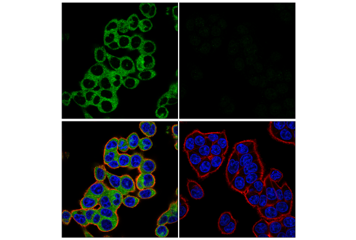 Immunofluorescence Image 1: KIF5B (E3H4J) Rabbit Monoclonal Antibody