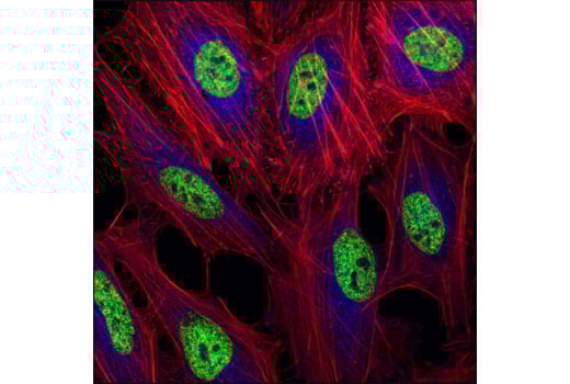 Immunofluorescence Image 1: Mono-Methyl-Histone H3 (Lys4) (D1A9) Rabbit Monoclonal Antibody