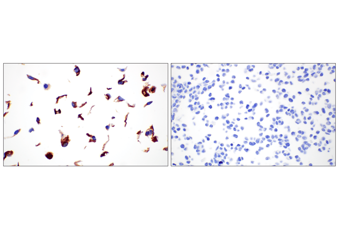 Immunohistochemistry Image 9: COL4A1 (E5M6R) Rabbit Monoclonal Antibody (IHC Formulated)