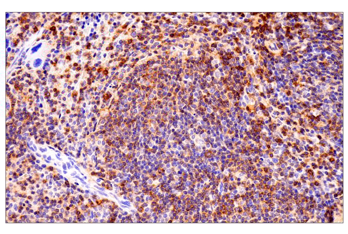 Immunohistochemistry Image 5: CD62L/L-Selectin (E7L2M) Rabbit Monoclonal Antibody (BSA and Azide Free)