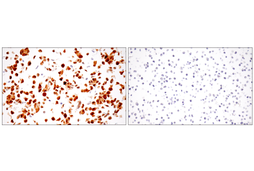 Immunohistochemistry Image 14: IL-18 (E3G8R) Rabbit Monoclonal Antibody