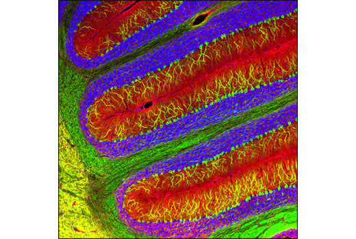Immunofluorescence Image 1: beta3-Tubulin (D71G9) Rabbit Monoclonal Antibody (BSA and Azide Free)