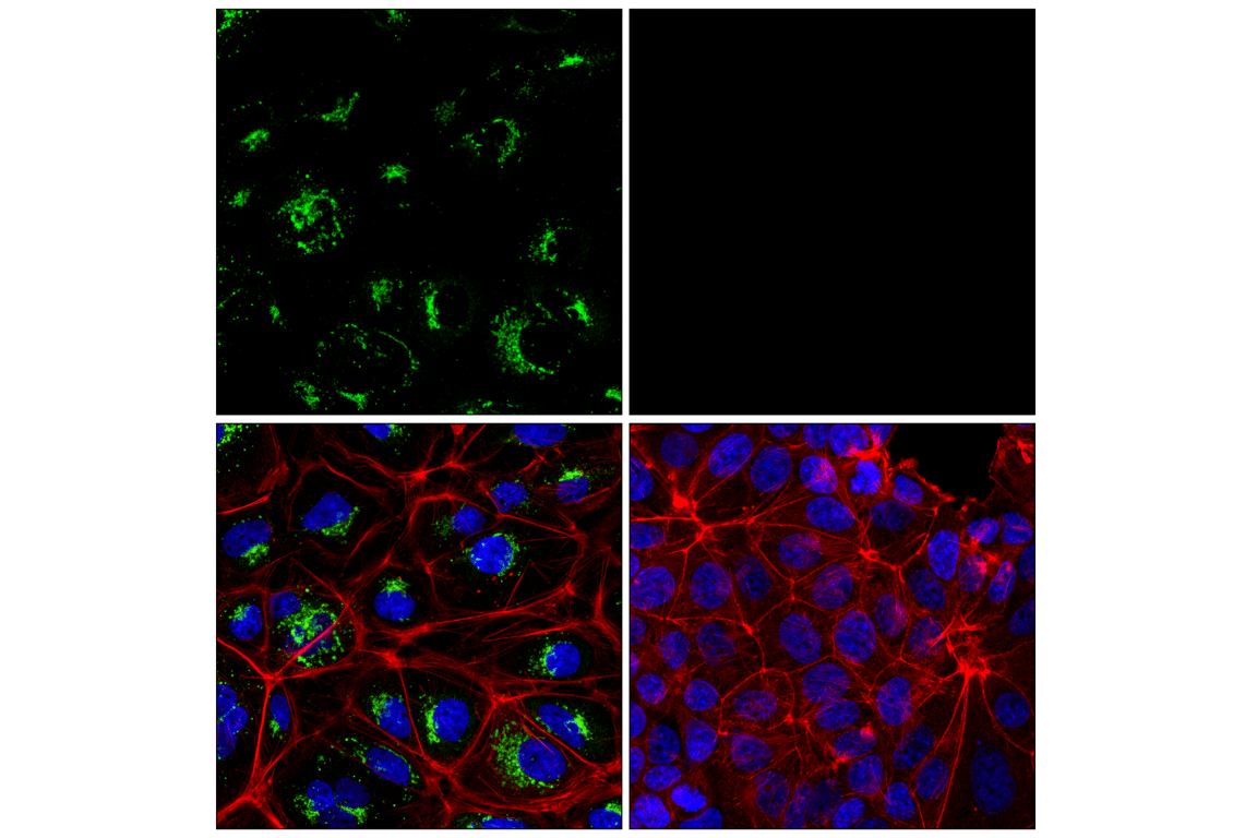 Immunofluorescence Image 1: AFP (C3) Mouse Monoclonal Antibody