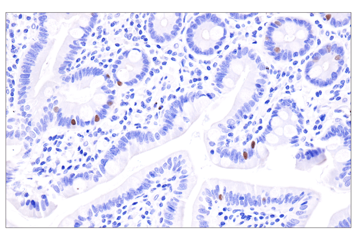 Immunohistochemistry Image 6: INSM1 (BLR272L) Rabbit Monoclonal Antibody
