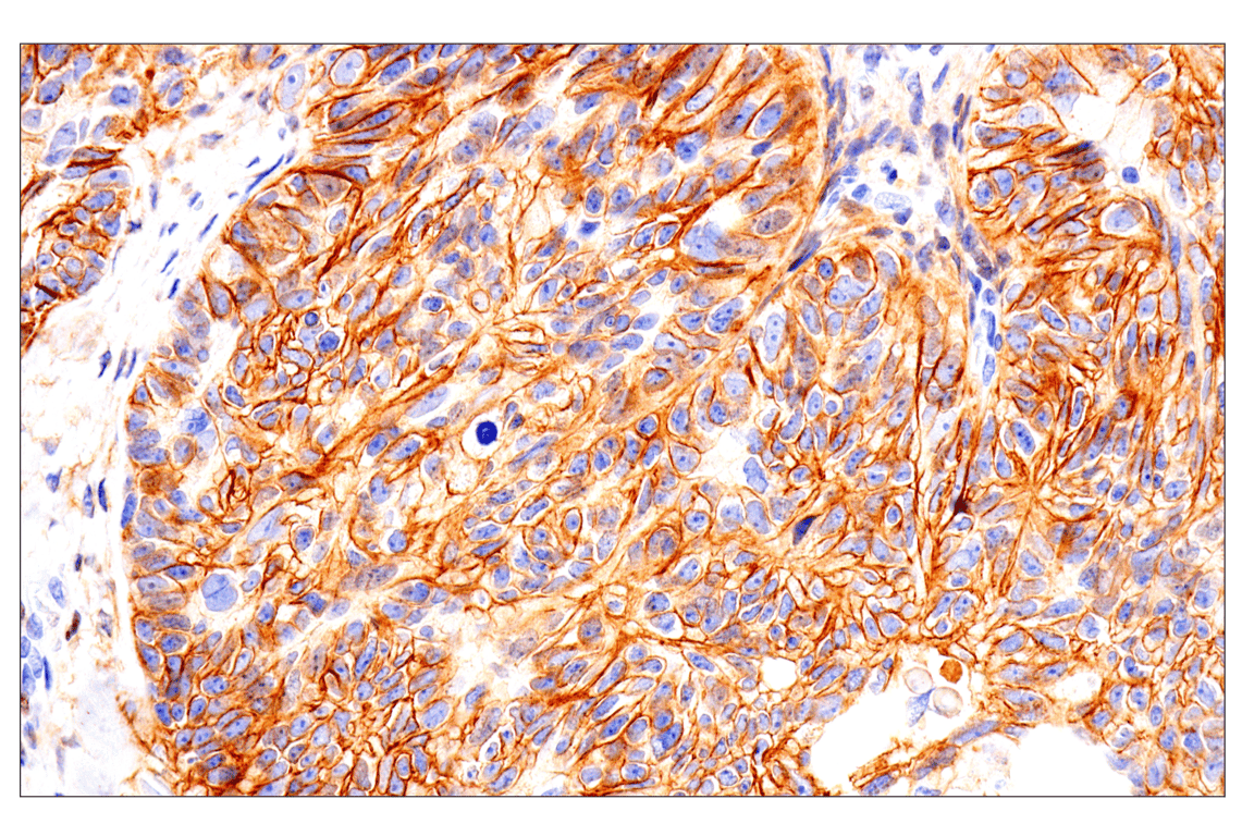 Immunohistochemistry Image 3: Notch2 (D76A6) Rabbit Monoclonal Antibody