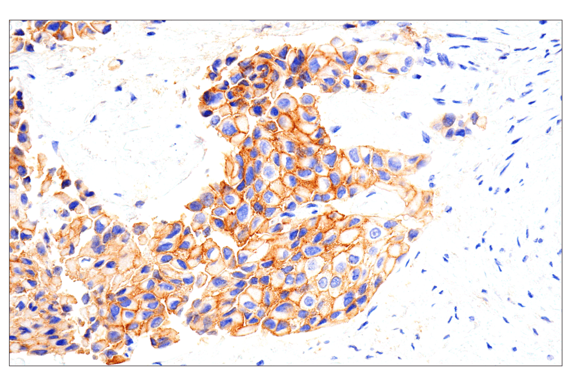 Immunohistochemistry Image 1: EphA2 (D4A2) Rabbit Monoclonal Antibody