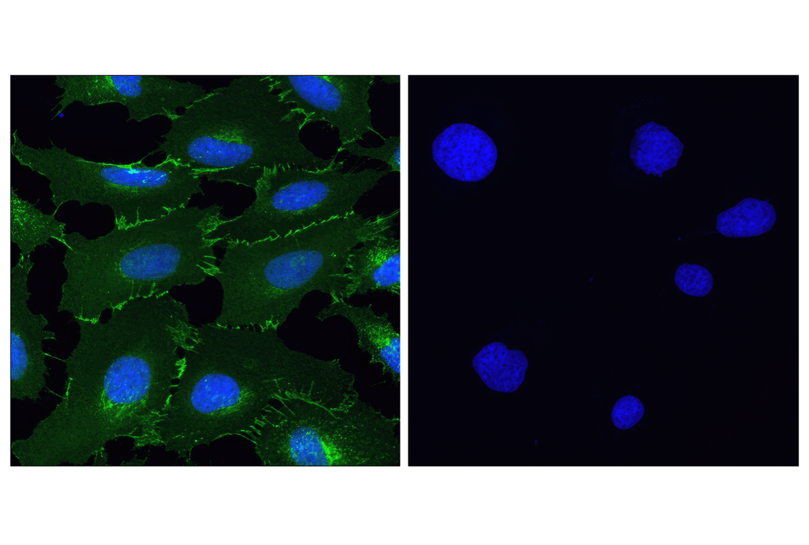 Immunofluorescence Image 1: beta-Catenin (D10A8) Rabbit Monoclonal Antibody