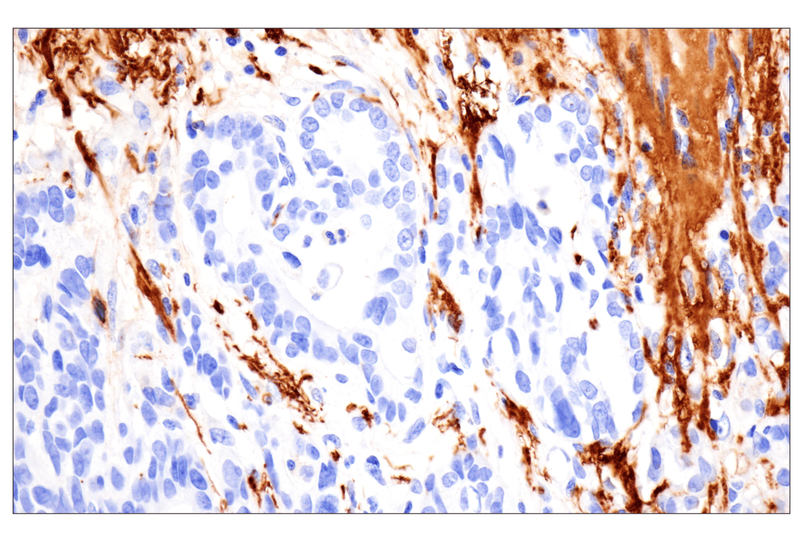 Immunohistochemistry Image 3: Vitronectin (F8D3L) Rabbit Monoclonal Antibody