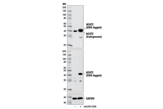 Western Blotting Image 2: ACAT2 (E1L8V) Rabbit Monoclonal Antibody