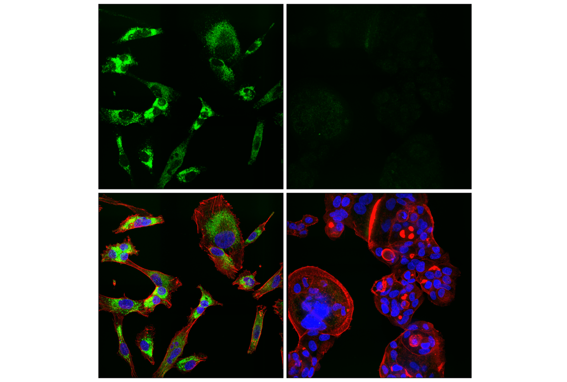 Immunofluorescence Image 1: NPC1 (E7S4N) Rabbit Monoclonal Antibody