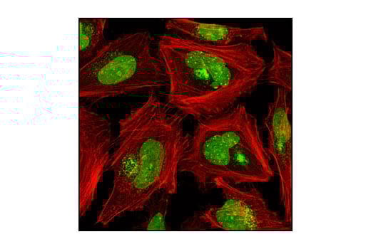 Immunofluorescence Image 1: SUMO-1 (C21A7) Rabbit Monoclonal Antibody