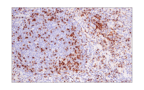 Immunohistochemistry Image 4: LAT (E3U6J) Rabbit Monoclonal Antibody (BSA and Azide Free)