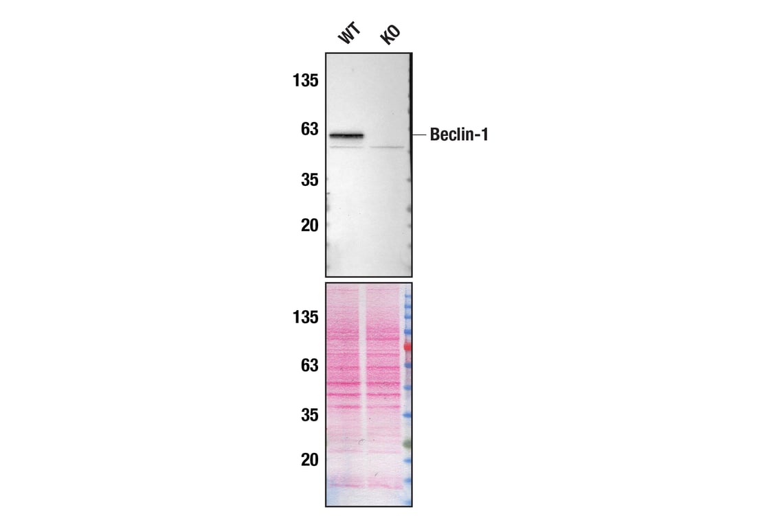 undefined Image 21: ULK1 Substrate Antibody Sampler Kit