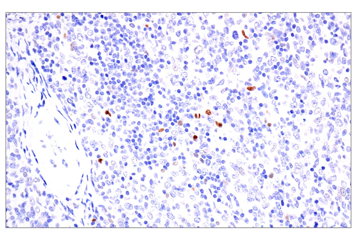 Immunohistochemistry Image 5: BATF3 (E3F3L) Rabbit Monoclonal Antibody