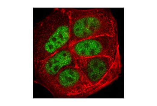 Immunofluorescence Image 1: AP-2 gamma Antibody