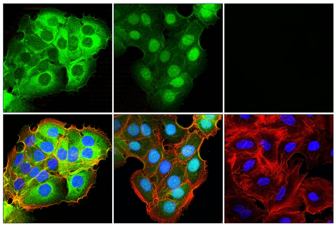Immunofluorescence Image 1: IRF-6 (E5C5D) Rabbit Monoclonal Antibody