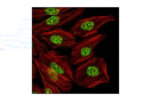 Immunofluorescence Image 1: Di-Methyl-Histone H3 (Lys36) (C75H12) Rabbit Monoclonal Antibody (BSA and Azide Free)