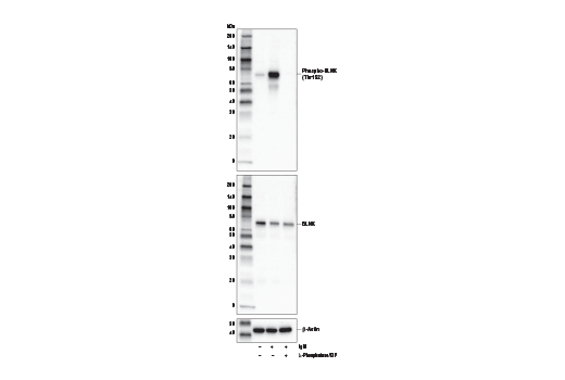 Western Blotting Image 2: Phospho-BLNK (Thr152) (E4P2P) Rabbit Monoclonal Antibody