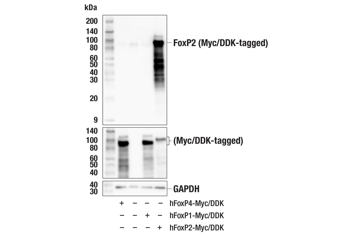 Western Blotting Image 2: FoxP2 (D55H9) Rabbit Monoclonal Antibody