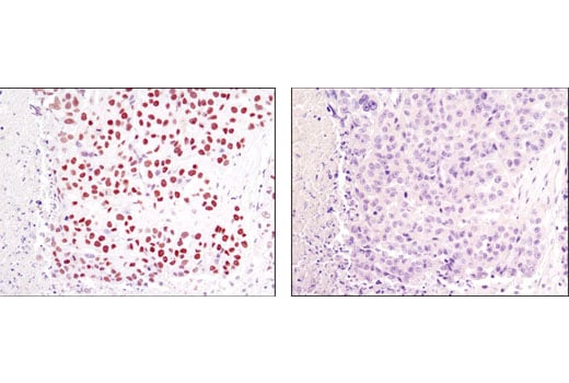 Immunohistochemistry Image 2: MTA1 (D40D1) Rabbit Monoclonal Antibody