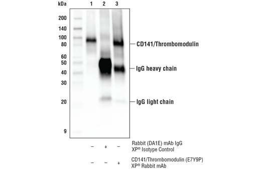 Immunoprecipitation Image 1: CD141/Thrombomodulin (E7Y9P) Rabbit Monoclonal Antibody