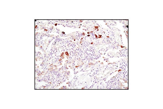 Immunohistochemistry Image 3: Fatty Acid Synthase (C20G5) Rabbit Monoclonal Antibody
