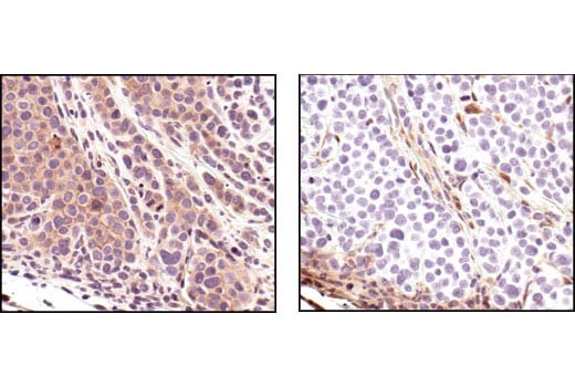Immunohistochemistry Image 5: Phospho-Akt (Ser473) (736E11) Rabbit Monoclonal Antibody