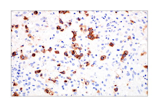 Immunohistochemistry Image 6: CD2 (D6V9F) Rabbit Monoclonal Antibody