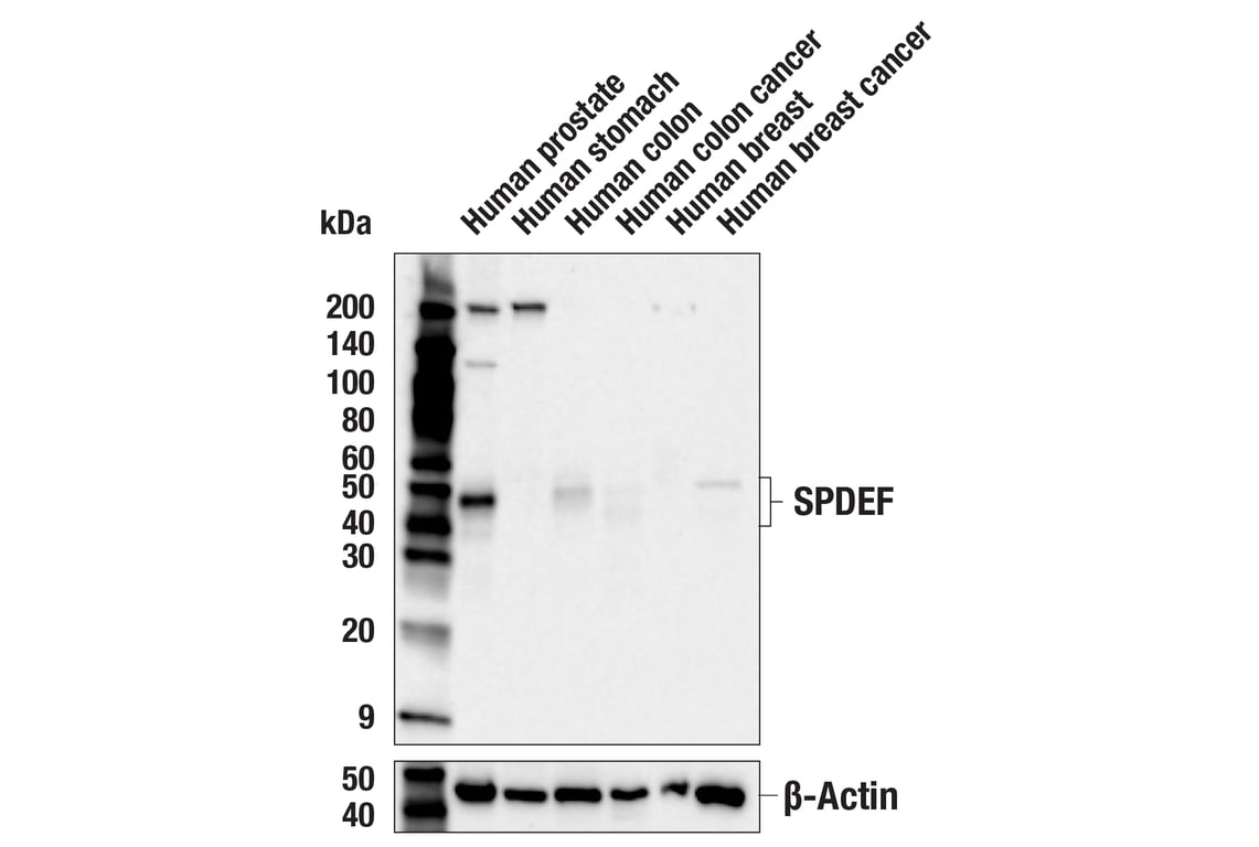 Western Blotting Image 3: SPDEF (F9M9S) Rabbit Monoclonal Antibody