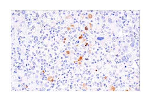 Immunohistochemistry Image 5: CXCL9/MIG (E6Z5W) Rabbit Monoclonal Antibody (BSA and Azide Free)