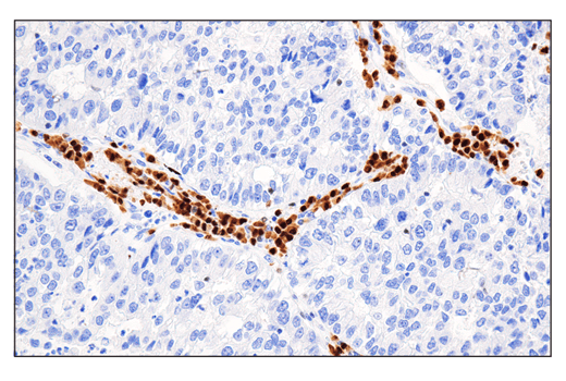 Immunohistochemistry Image 1: IRF-4 (E8H3S) XP<sup>®</sup> Rabbit mAb