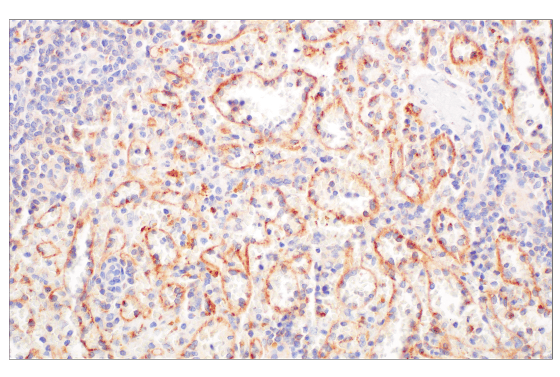 Immunohistochemistry Image 7: LY6E (F8Y1R) Rabbit Monoclonal Antibody