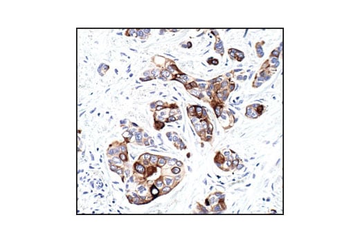 Immunohistochemistry Image 2: Phospho-mTOR (Ser2448) (49F9) Rabbit Monoclonal Antibody