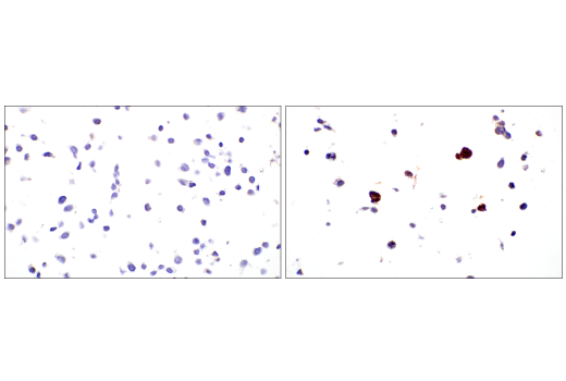 Immunohistochemistry Image 6: Periostin (E5F2S) Rabbit Monoclonal Antibody