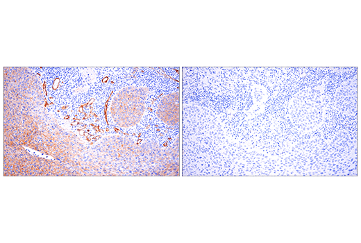 Immunohistochemistry Image 3: Insulin Receptor β (E9L5V) XP<sup>®</sup> Rabbit mAb (BSA and Azide Free)