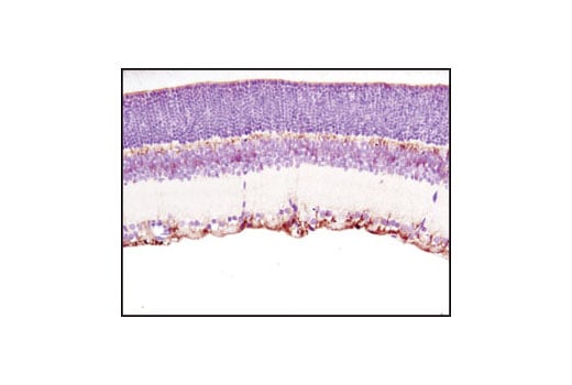Immunohistochemistry Image 2: DARPP-32 (19A3) Rabbit Monoclonal Antibody
