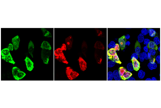 Immunofluorescence Image 1: Cas9 (7A9-3A3) Mouse mAb (Alexa Fluor<sup>®</sup> 555 Conjugate)
