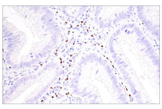 Immunohistochemistry Image 2: Olig2 (E6G6Q) Rabbit Monoclonal Antibody