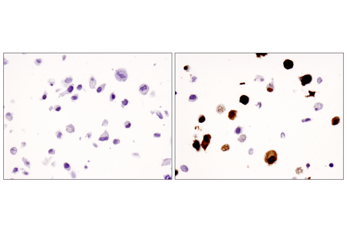 Immunohistochemistry Image 4: FoxP3 (D2W8E<sup>™</sup>) Rabbit mAb