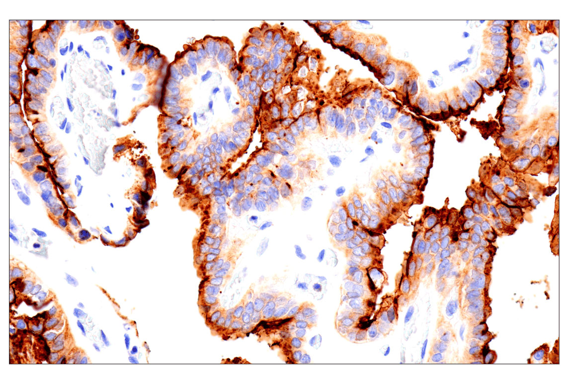 Immunohistochemistry Image 2: NaPi2b/SLC34A2 (D6W2G) Rabbit Monoclonal Antibody