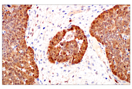 Immunohistochemistry Image 4: p16 INK4A (BC42) Mouse Monoclonal Antibody