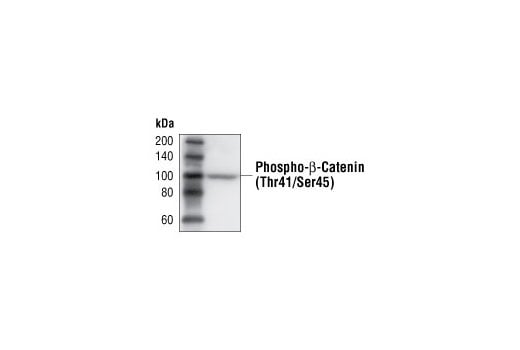 undefined Image 14: beta-Catenin Antibody Sampler Kit
