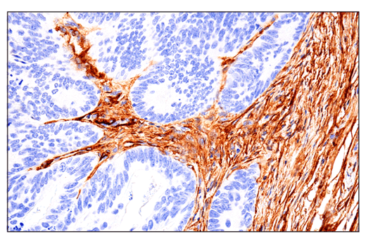 Immunohistochemistry Image 1: CD248 (E9Z7O) XP<sup>®</sup> Rabbit mAb (BSA and Azide Free)