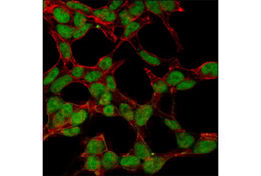 Mismatch DNA Repair (MMR) Antibody Sampler Kit | Cell