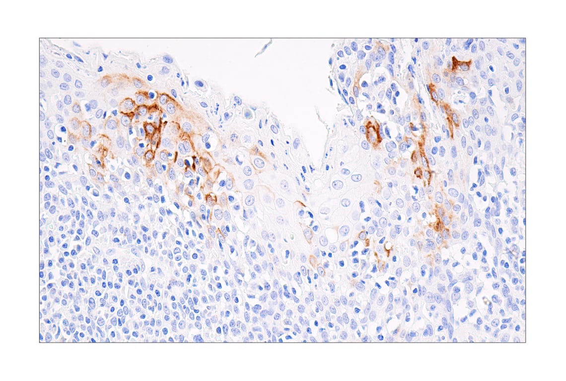 Immunohistochemistry Image 4: CXCL9/MIG (E6Z5W) Rabbit Monoclonal Antibody