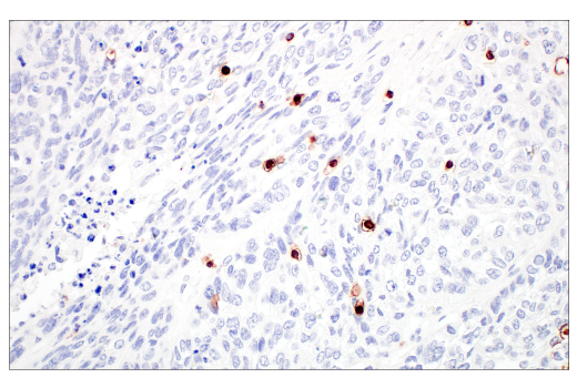 Immunohistochemistry Image 6: CD7 (E4G1Q) Rabbit Monoclonal Antibody