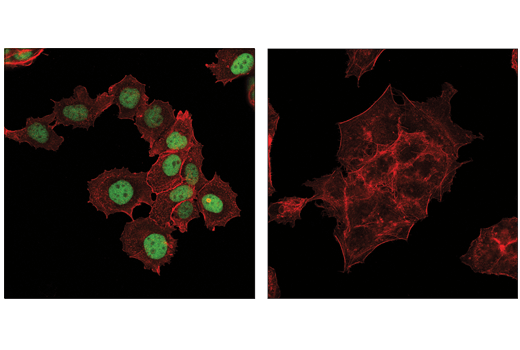 Immunofluorescence Image 1: GATA-3 (E2N1Y) Mouse Monoclonal Antibody (BSA and Azide Free)