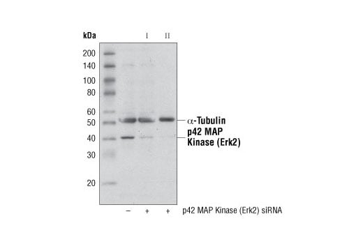 undefined Image 1: SignalSilence<sup>®</sup> p42 MAP Kinase (Erk2) siRNA II